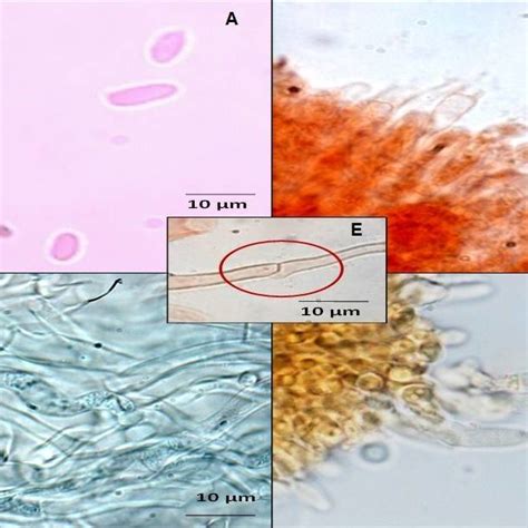 Light microscope photographs A. Basidiospores, B. Basidia, C. Pileus ...