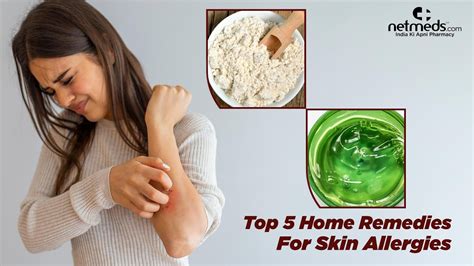 5 Best Natural Remedies For Skin Allergies - YouTube