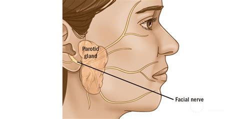 Parotidectomy (parotid tumor surgery): description, types of surgical ...