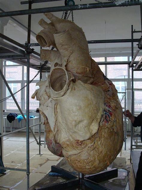 Here is a picture of a real preserved blue whale heart. It is 440 ...