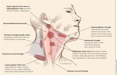 Evaluation of Neck Masses in Adults | AAFP