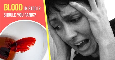 Blood in Stool - Causes, Symptoms, Treatment & Prevention