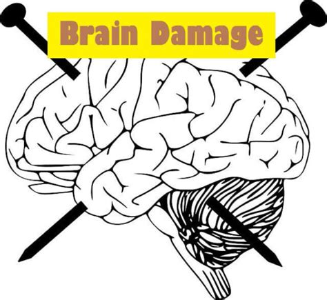 15 Brain Damage Causes And Symptoms » 2024