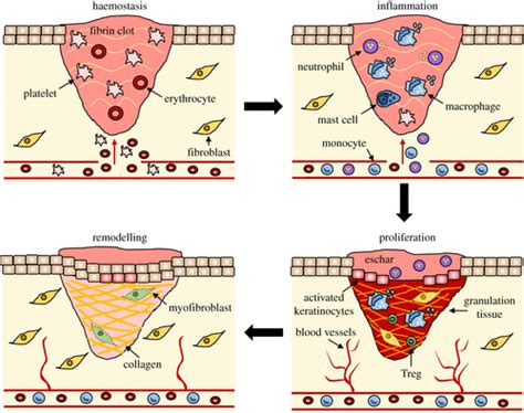 Wound healing: cellular mechanisms and pathological outcomes | Open Biology