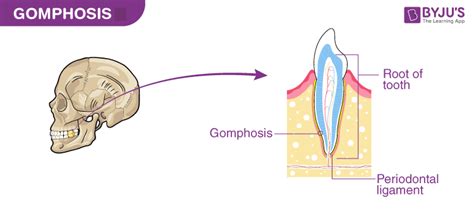 Fixed Joint Diagram