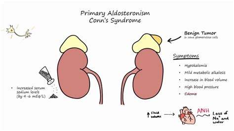 Where Is Aldosterone Secreted From - slideshare