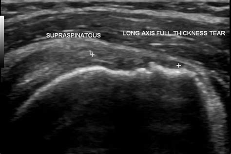 Ultrasound Scan For Diagnosis | Ultrasound Imaging | Physiocare