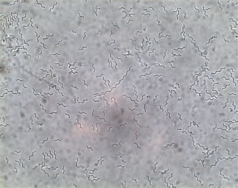 ESA - Bacteria through a microscope