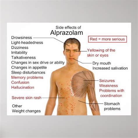 Side Effects Chart for the Drug Alprazolam Poster | Zazzle