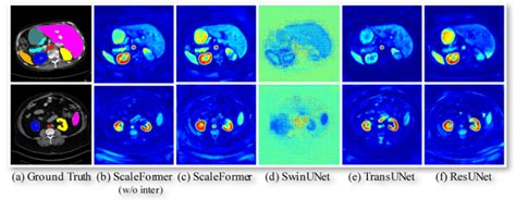 Visualization of the feature map of various methods. | Download ...