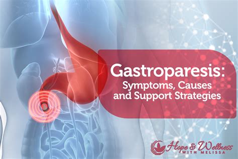 Gastroparesis: Symptoms, Causes and Natural Support Strategies - Hope ...