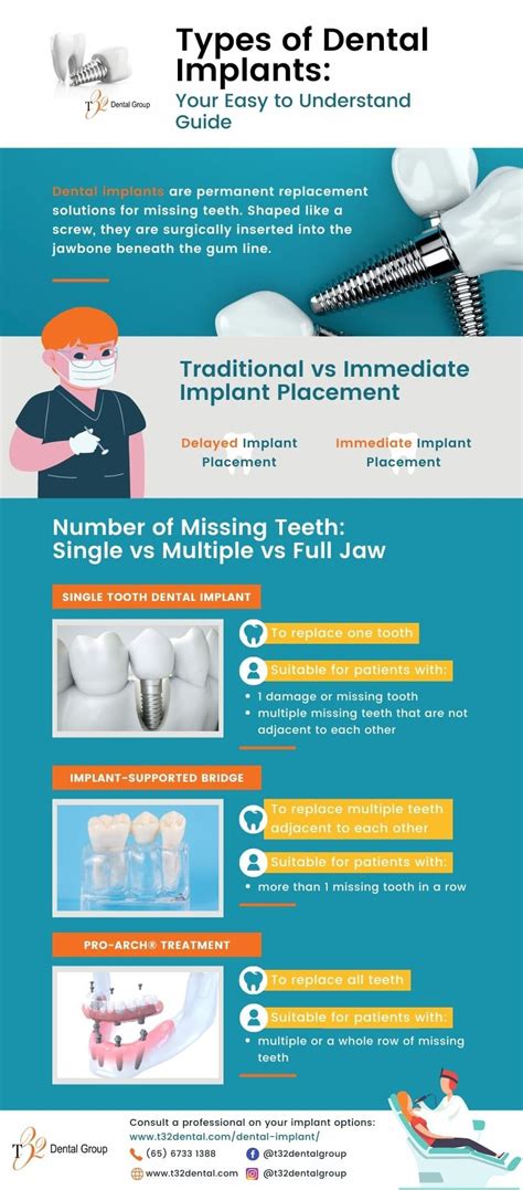 Types of Dental Implants – Your Easy-to-Understand Guide