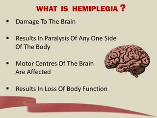 What Is Hemiplegia ? - Causes, Symptoms, Diagnosis and Treatment For ...