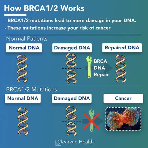 14 Brca 1 Mutation Gene Journey ideas in 2021 | brca, mutation, cancer