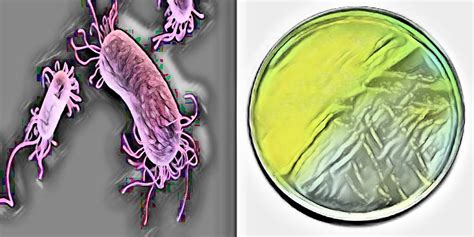 Morphology And Culture Characteristics Of Pseudomonas aeruginosa