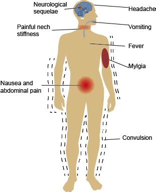 Japanese Encephalitis Virus - Creative Diagnostics