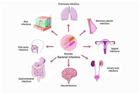 Bacterial infections can affect your skin, lungs, brain, blood and ...