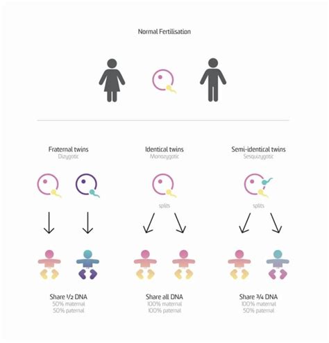 When Identical Twins Aren't Identical | LocalHealthGuide