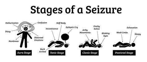 What to do if Someone is Having a Seizure - Premier Neurology ...