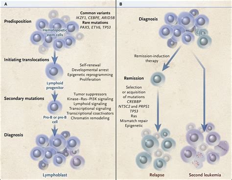 Pathophysiology Of Acute Lymphocytic Leukemia