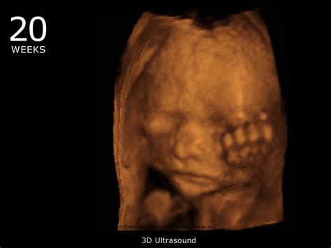 20 Week 3D Ultrasound Baby Picture | Pregnancy Symptoms Week by Week