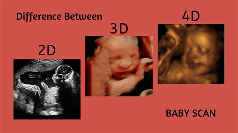 Difference Between 2D, 3D, And 4D Baby Scan | 4d ultrasound, Baby scan ...