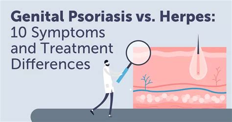 Genital Psoriasis vs. Herpes: 10 Symptom and Treatment Differences ...