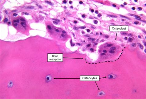 Osteoclast Histology