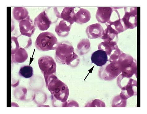 1a hematology slides