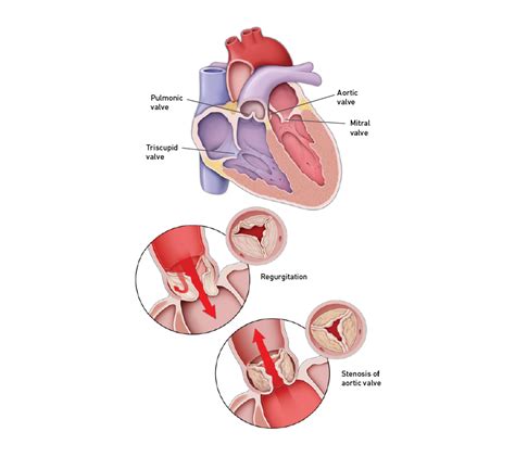 [DIAGRAM] Diagram Of A Heart Valve - MYDIAGRAM.ONLINE