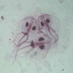 Giardia lamblia