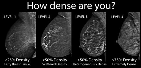 Breast Density: How to See Clearly Through the Fog | HuffPost