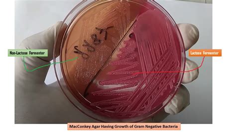 MacConkey Agar : Introduction, Principle, Composition, Preparation, Pro