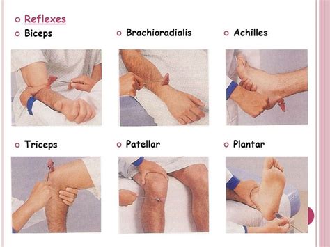 Biceps, Triceps, and Brachioradialis Reflex