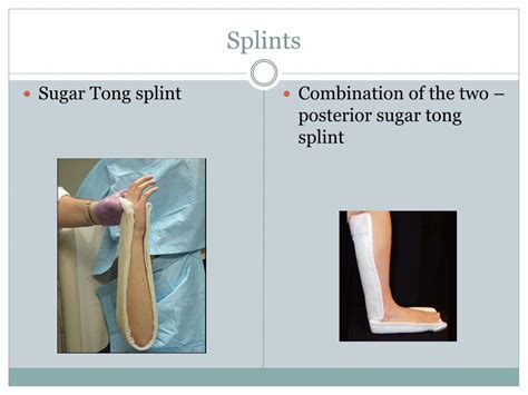 Sugar Tong Splint Ankle