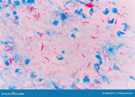 Tuberculosis Bacterium