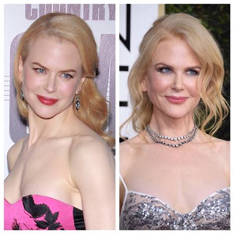 Nicole Kidman’s Before and After Photos Look Different, but She Denied ...