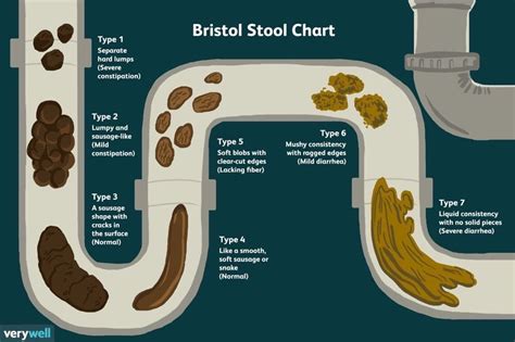 Pin by aspen brown on health & beauty | Bristol stool chart, Stool ...