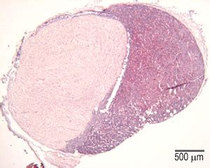 pituitary gland slide anterior and posterior - bailey-island-hobo-bag ...