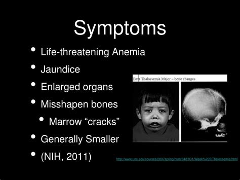 PPT - Beta-Thalassemia PowerPoint Presentation, free download - ID:1756801