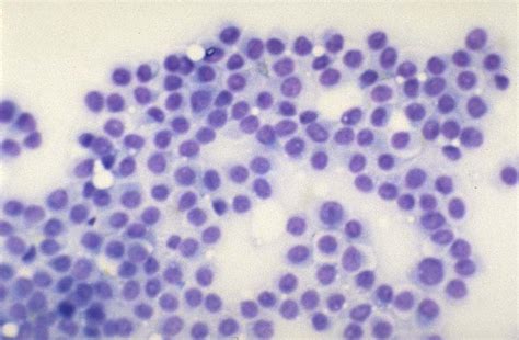 Cytology: histiocytoma in Dogs (Canis) | Vetlexicon