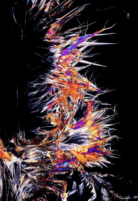 Plm Of Crystals Of Cholesterol Photograph by Sidney Moulds/science ...