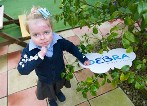 Five-Year-Old Launches Campaign For People With Butterfly Skin Disease