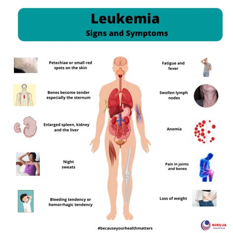 Leukemia: Signs and Symptoms