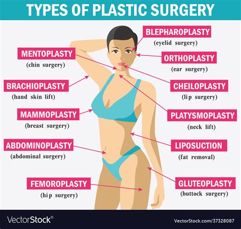 Medicine plastic surgery infographics types Vector Image