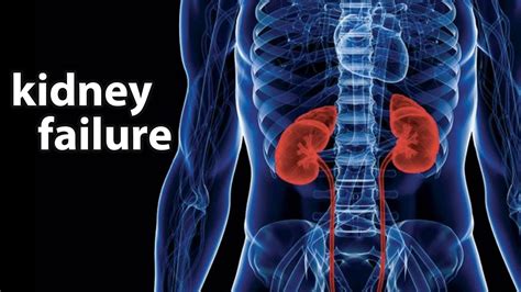 What Is Kidney Failure? Cause, Symptoms, Treatments | Healthtian