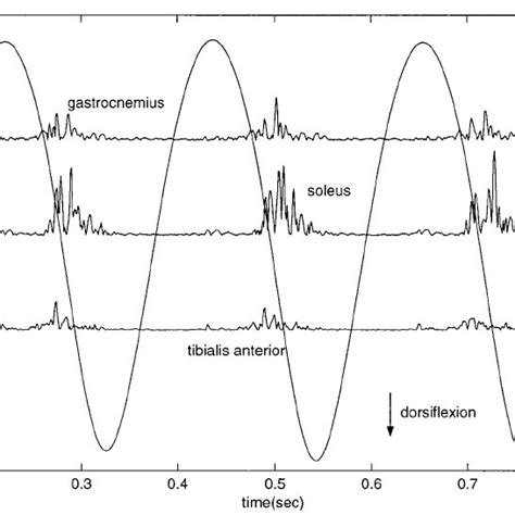 Sequence of events during clonus. Following a muscle contraction, the ...