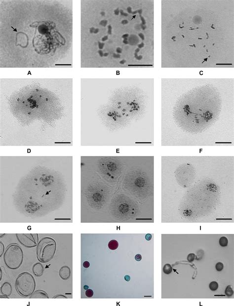 (Colour online) Meiotic abnormalities in hexaploid hybrids of napier ...