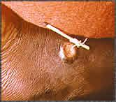 SAVANNAH NEWS: GUINEA WORM DISEASE DROPS DRASTICALLY IN SVELUGU/NANTON