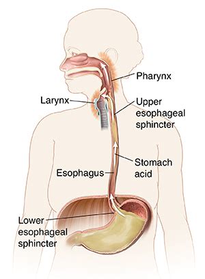 How Acid Reflux Affects Your Throat | Saint Luke's Health System